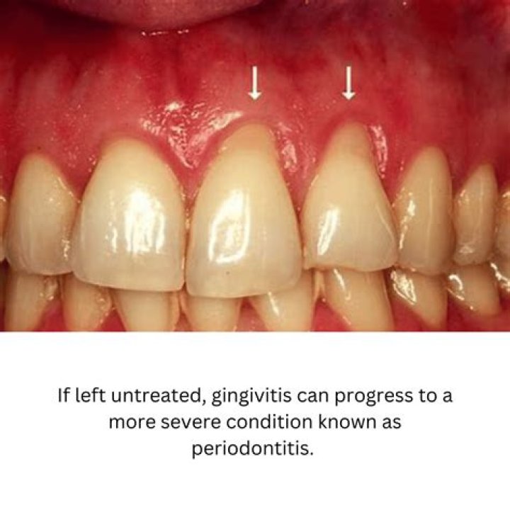 Do injections in the gum hurt?
