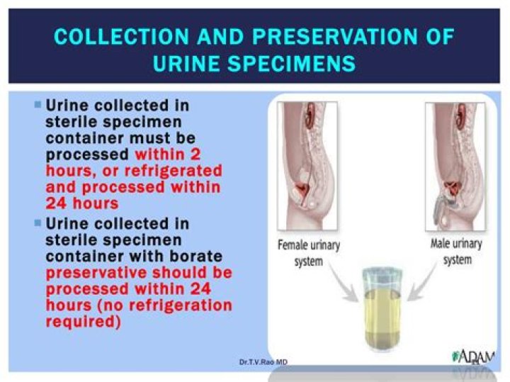 Do urine specimens have to be refrigerated?