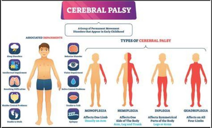 Has cerebral palsy decreased?