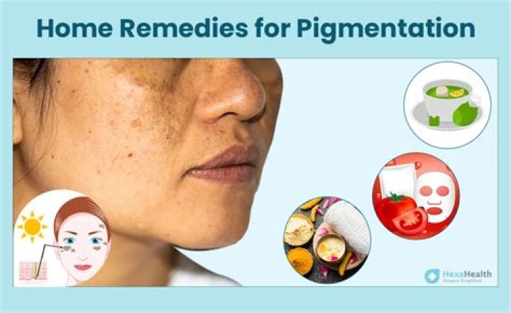 How do i get rid of pigmentation?