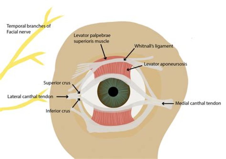 Is canthotomy a medical term?