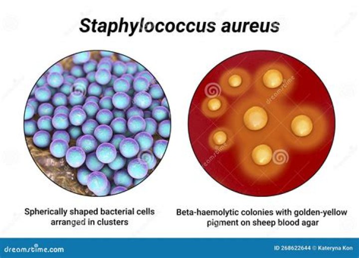 What does aureus mean in english?