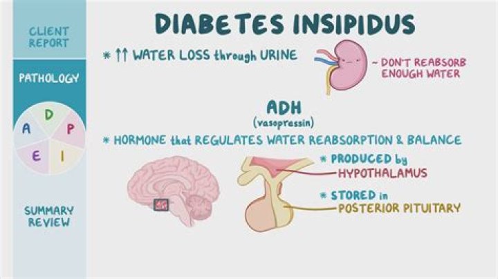 What is dipsogenic diabetes insipidus?
