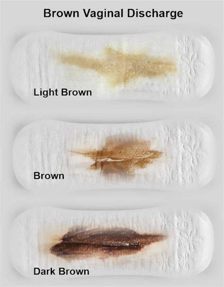 When i wipe there's brown discharge?
