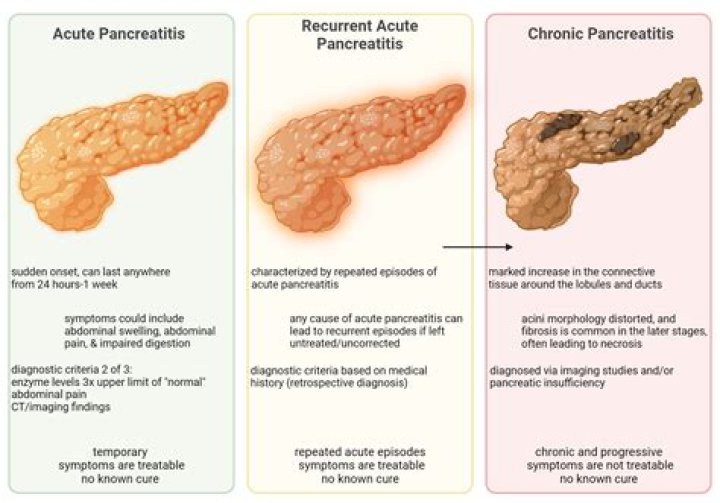 Where do u feel pancreatic pain?