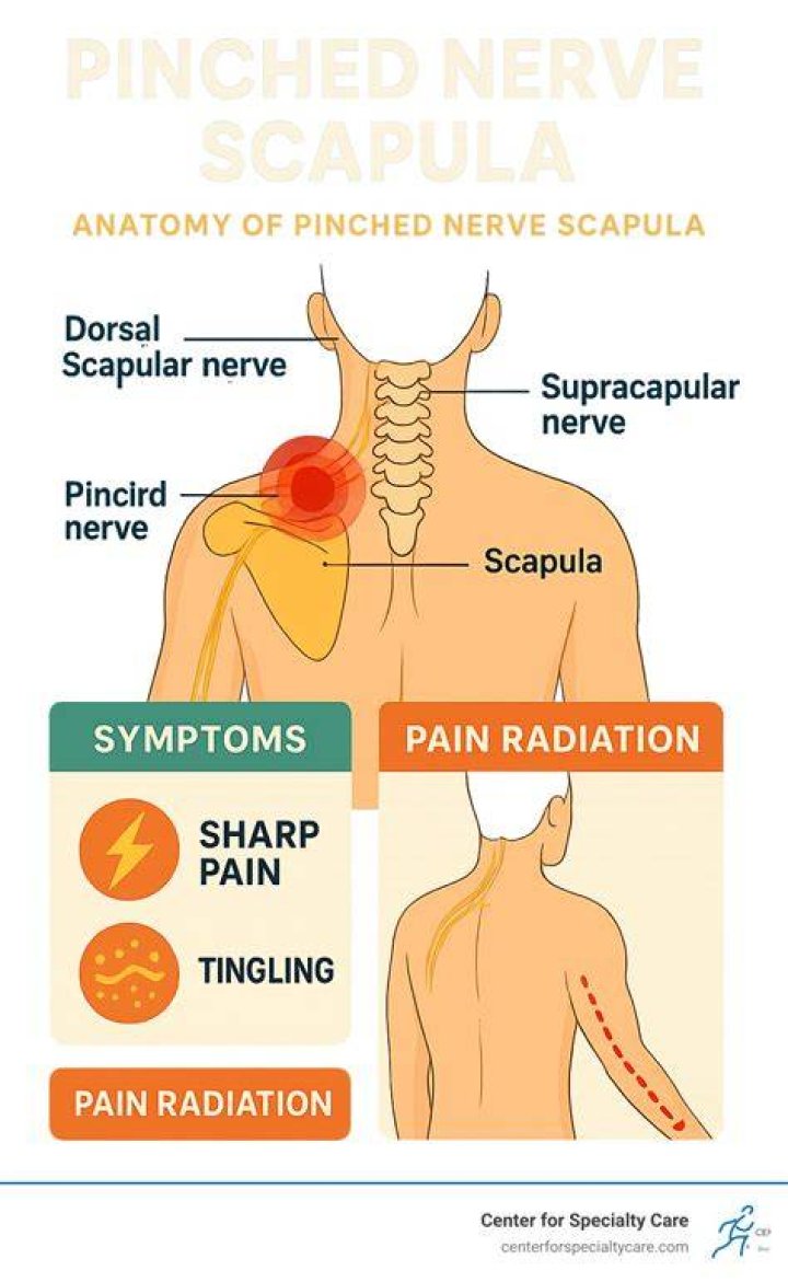 Where does a pinched nerve in the neck hurt?