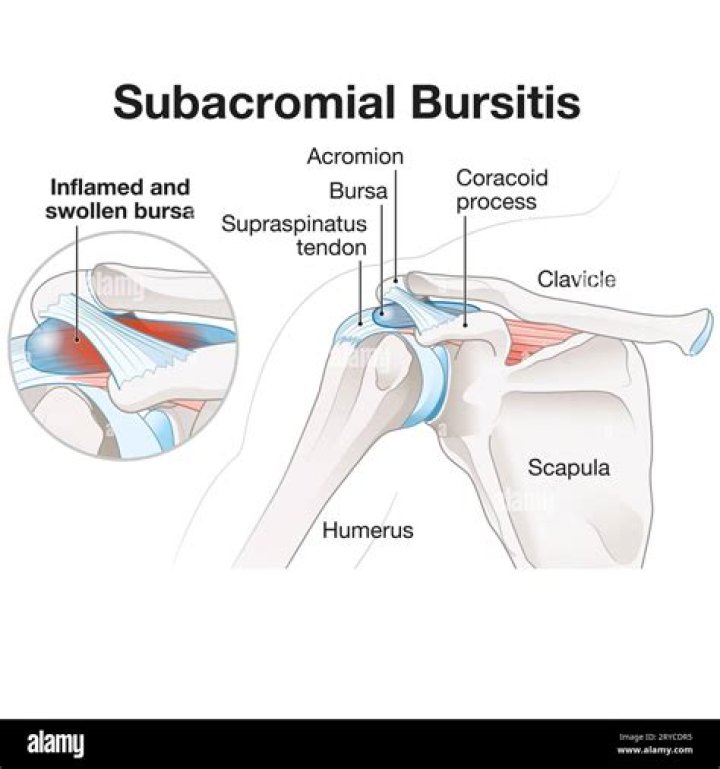 Where is supra-acromial bursa?